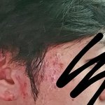 [개깊은빡침] 봐주세요 다운펌으로 피부 <b>박살</b> 났습니다 (약혐 주의)