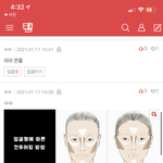 [19] 입 커지는법
