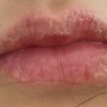 입술튼거 관리법 좀 제발 ㅠㅠㅠ