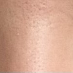 [댓글부탁해] 나 이거 <b>쌍수</b> 망한거 아니냐?