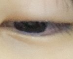 아 썅 눈 <b>개부</b>었다