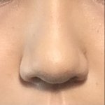 [이것좀봐줘] 나 코 ㄹㅇ 복코인데 <b>쉐딩</b> 어떻게 해?