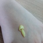 손에서 <b>버섯</b>이 자랐어 ㅅㅂ..