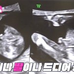 초음파만으로 <b>성별</b> 알 수 있나요??