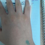 이거 무슨 증상이야??