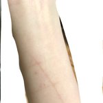 이거 자해<b>흉터</b>같음..?