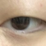 얘들아 나 쌍수 더 굵게 재수술 할까 사진 내림