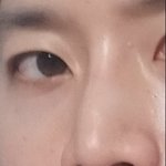 <b>눈</b>이랑 코<b>성형</b> 고민임