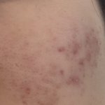 [조언부탁해] (<b>사진</b>) <b>이런</b> 피부는 어케 해야되는지ㅠㅠ