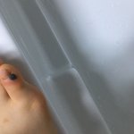 아니 <b>피멍</b> 들었는디 이거 스스로 빠지긴 함?