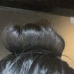 나 <b>탈모</b>일까?? ㅠㅠ