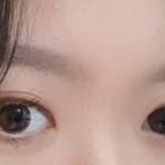 <b>점막</b> 채운거 안채운거 추반좀