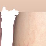 튼살 땜에 이런데 첨 글 써봐