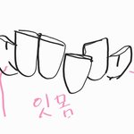 [댓글부탁해] 나 <b>이빨</b> 교정 당연히 해야겠지??;