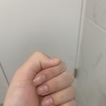 [드루와] 나 <b>손톱</b> 기형인듯ㅠㅠ