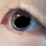 [댓글부탁해] 나 <b>쌍꺼풀</b> 생길 수 있을까