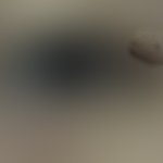 [19] 오 나 눈 <b>위에</b> 점 생김!!! ㅠ