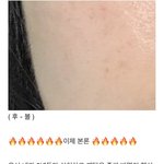 커뮤 <b>성지</b>글 ㄹㅇ 피부 꿀 정보 같아서 들고옴 ㅅㄱ