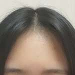 [조언부탁해] 나 <b>이마</b> 너무 긴데 줄이는방법 없냐