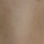 [꼭조언부탁] 나 쌍수 잘된거 같아 ??