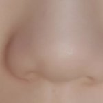 [댓글부탁해] 이런 콧망울은 <b>시술</b>이나 성형없인 가망 없는거지?