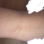 [조언부탁해] <b>반바지</b> 입을 수 있을까요?