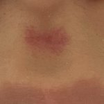 [댓글부탁해] ㅅㅂ 어떡해 나 <b>인중</b>에 키스마크 생김