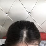 <b>아닉</b> 다들 정수리 이래?