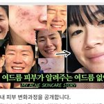 피부의 <b>완성</b>은 얼굴