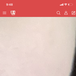 얘들아 <b>솜털</b> 못없애냐