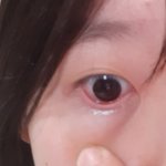 방금 결막염렌즈쓰<b>닌데</b>