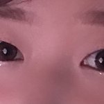 [댓글부탁해] 쌍수 망한건지 봐주세요 ㅠㅠ