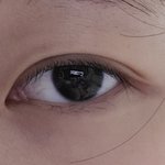 [이것좀봐줘] 나 꼬막눈 같은데 뒷트임 할까 ㅠㅠ