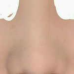 복코 <b>쉐딩</b> 전후 오지지