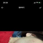 여드름 고민 ㅜㅜ <b>답글</b> 기다려요 ㅠㅠ