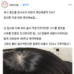 [댓글부탁해] 아니 시12발 나 <b>탈모</b>야??