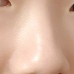 [댓글부탁해] 나 <b>코</b>성형시급하냐