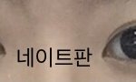 [댓글부탁해] 쌍수 <b>재수술</b> 할말????