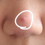 [댓글부탁해] 아니 진짜 큰일났어;;; <b>코에</b> 조카 큰 여드름