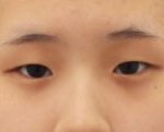[꼭조언부탁] <b>작년</b>에 쌍수한 대학교 샌액긔인데..괜찮은지 봐주라...