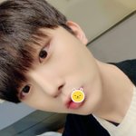 [이것좀봐줘] <b>눈매</b>교정했는데 수술한게 더 나은가요??..