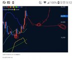 [코인] 돈4배로 버는 차트분석법 <b>right</b> breast nipple