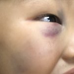 [꼭조언부탁] 아이아빠가 아이를 때렸습니다..