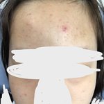나 피부 <b>개안</b>좋은데 관리로 가능하냐