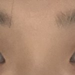 [댓글부탁해] 나 쌍수할건데 함만봐줘 젭R
