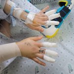 알바생인 제가 물려서 다리가 괴사됬습<b>아다</b>. 제 잘못이라고 금액 부담을...