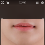 이런 입꼬리는 <b>시술</b>로못만듬?