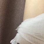 <b>에어</b>프라이어때문에 다침