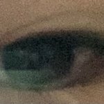 나 자고일어났는데 쌍꺼풀 생김