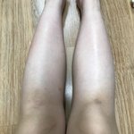 종아리 너무 극단적으로 짧은데 어떡함